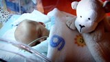 Comprendre les problèmes respiratoires des bébés prématurés.