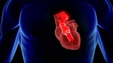 Créer une valve aortique à partir de cellules humaines