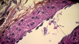 Reportage 1 :<br>
Livrer un médicament directement à un organe malade grâce à une petite bille magnétisée.