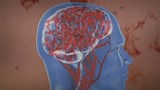 Reportage 2:<br>
Une nouvelle arme contre le cancer.