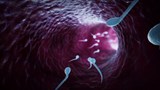 Reportage 1 :<br>
Une nouvelle méthode pour évaluer la fertilité masculine.