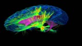 Reportage 2 :<br>
Les routes secondaires du cerveau