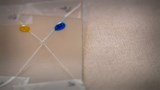 Reportage 1:<br>
Dépister des maladies avec un simple fil.