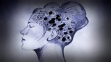 Alzheimer : poser le bon diagnostic.