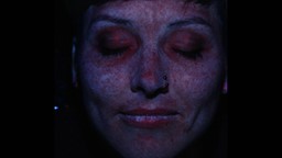 Un photomaton ultraviolet pour voir les dommages du soleil sous la peau.