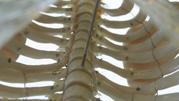 Marianne au labo : une molécule dérivée de la vitamine D pour améliorer la guérison des fractures.